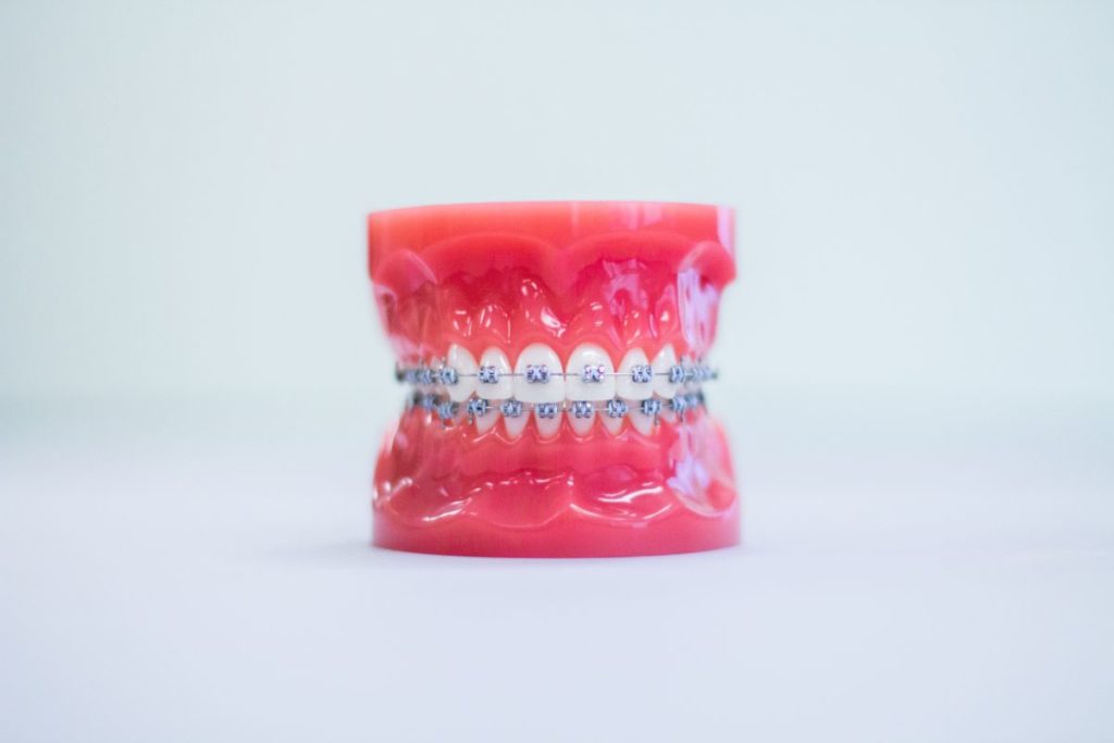 Braces Myths You Need to Know | Sycamore Orthodontics